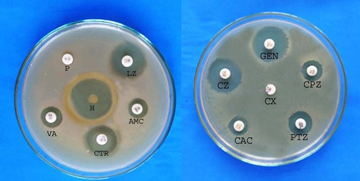 JCDR - Antibacterial activity, Kirby-bauer disc diffusion, Minimum  inhibitory concentration, Zone of Inhibition