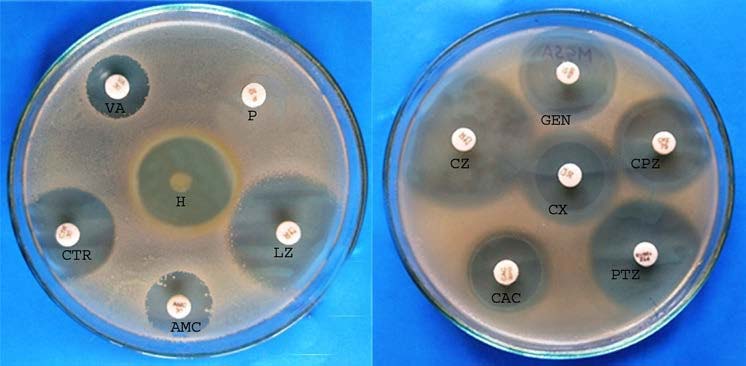 JCDR - Antibacterial activity, Kirby-bauer disc diffusion, Minimum  inhibitory concentration, Zone of Inhibition