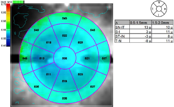 Pachymetry Chart