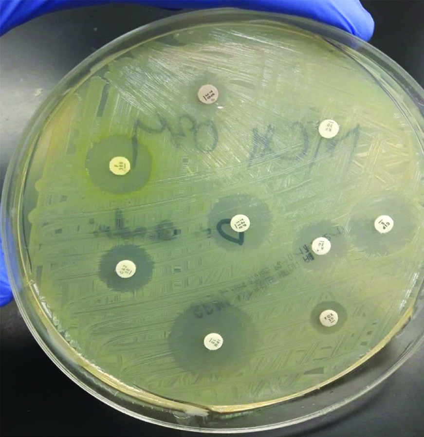 Antibiotic sensitivity profile of urinary bacterial isolates ...