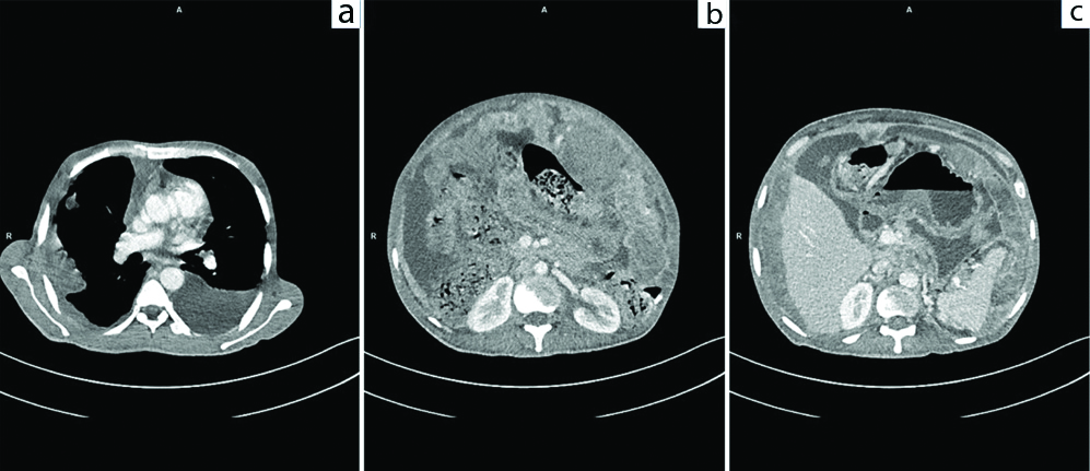 questions to ask radiation oncologist breast cancer