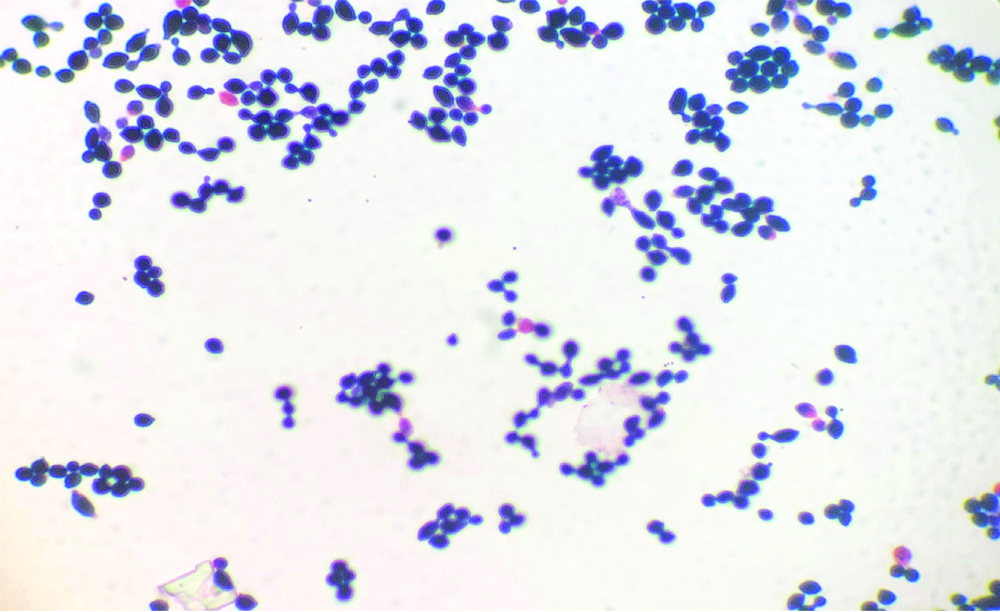 budding yeast gram stain