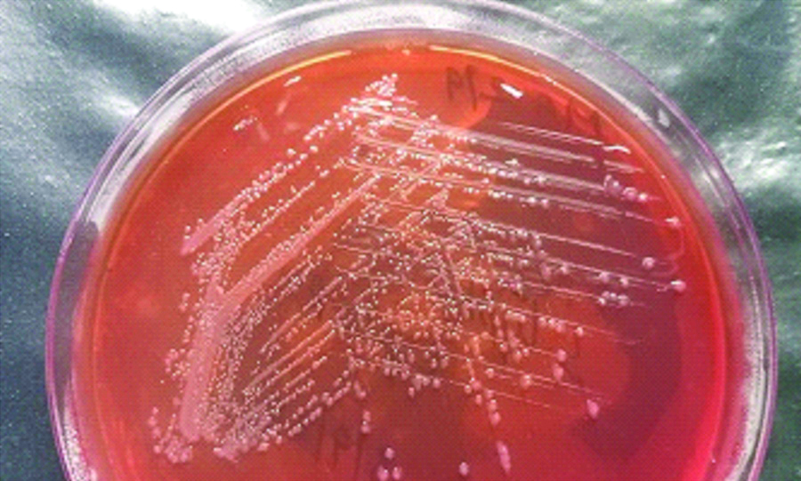 pseudomonas aeruginosa on macconkey agar