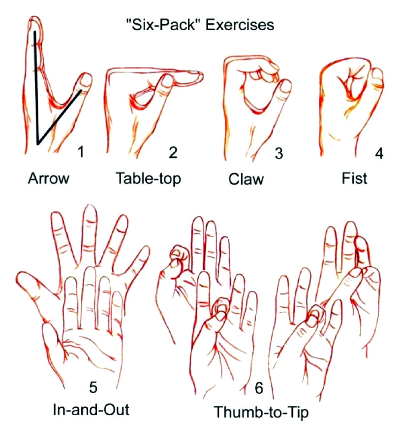 Инсульт гимнастика руки. Упражнения для руки при инсульте. Гимнастика для рук после инсульта. Упражнения для кистей рук при инсульте. Лечебная физкультура для пальцев рук.