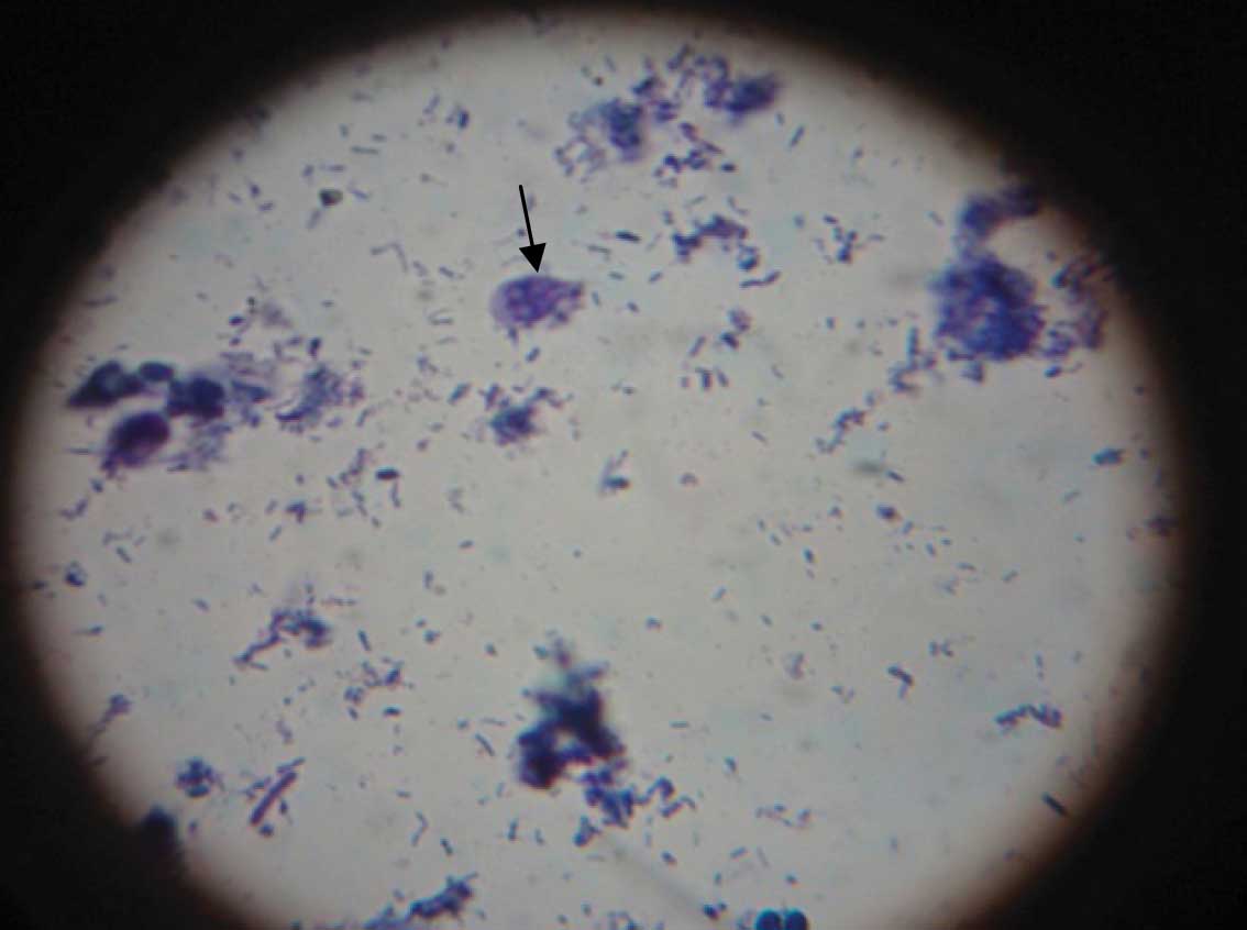 giardia cysts are able to withstand