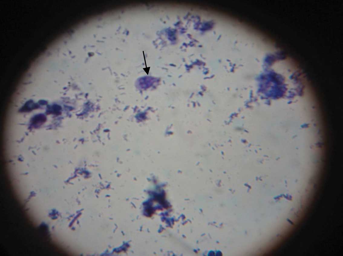 Giardia cysts are able to withstand -