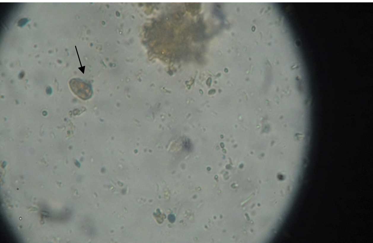 giardia cysts in stool images
