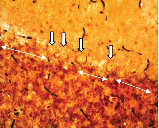 Control cerebellar cortex showing Purkinje cells (arrow). (H&E Stain X400)