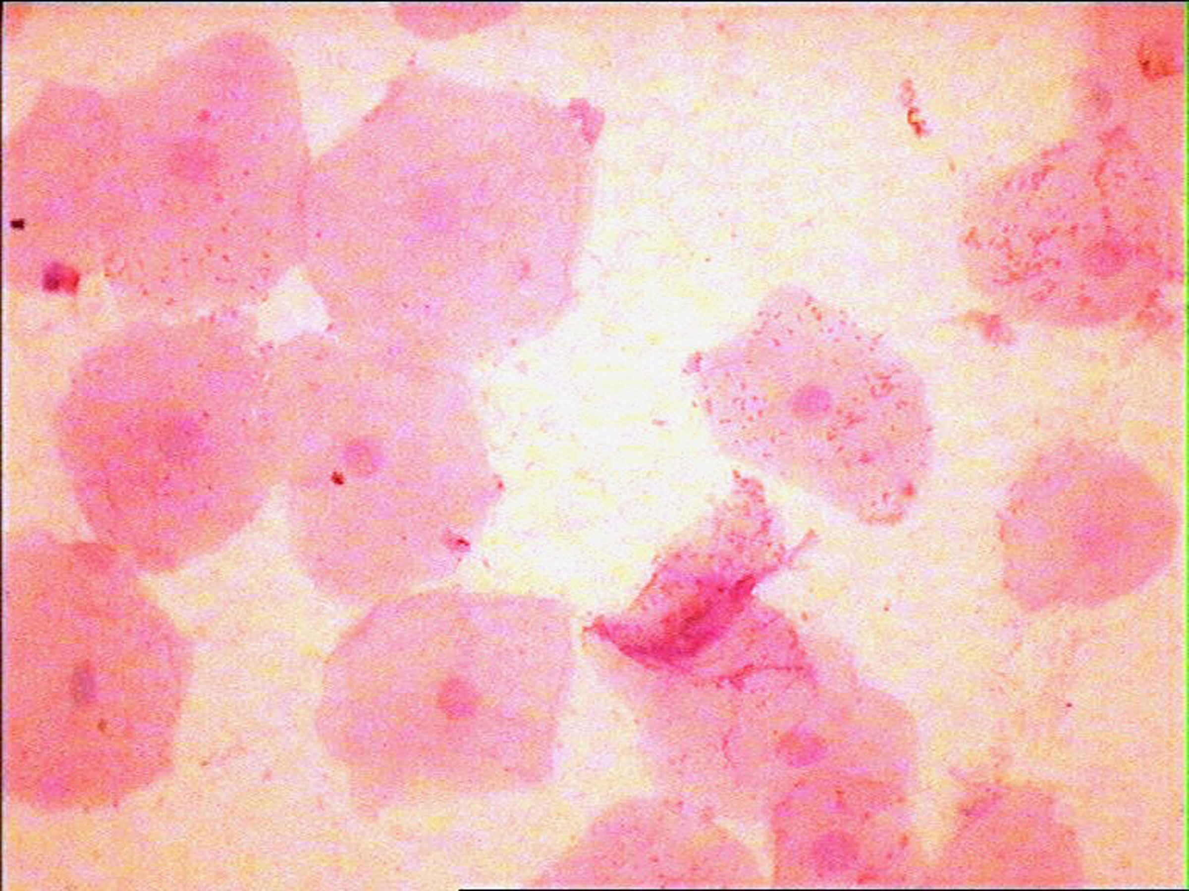 Эпителий клетки цилиндрического эпителия слизь. Мазок шейки матки микроскопия. Трихомонада микроскопия эпителиальная клетка. Плоский эпителий женский мазок. Буккальный эпителий мазок.