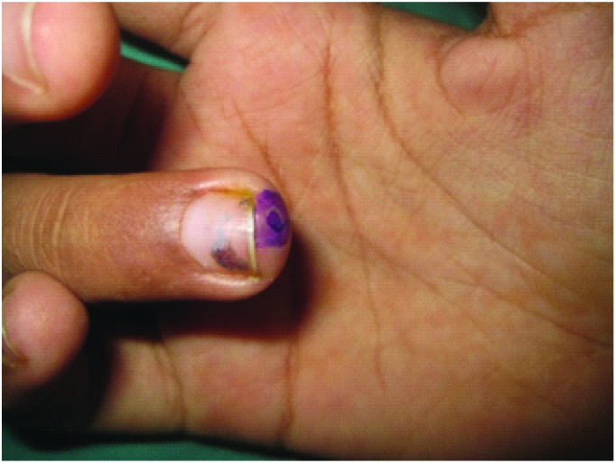 Approaching Abnormal, Inflamed, and Infected Nails