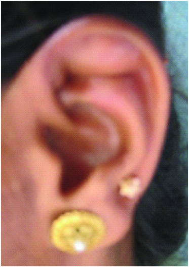 Scaphoid Fossa Piercing