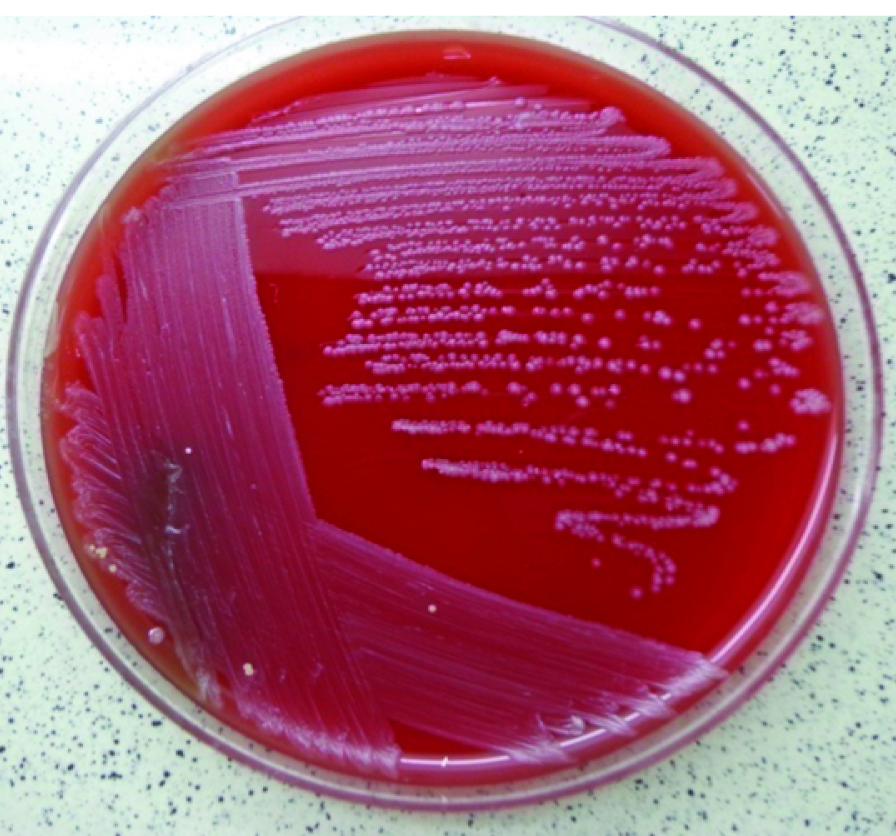 corynebacterium xerosis colony morphology