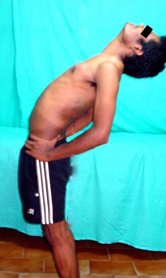 Lateral view of subject performing the standing back extension test ...