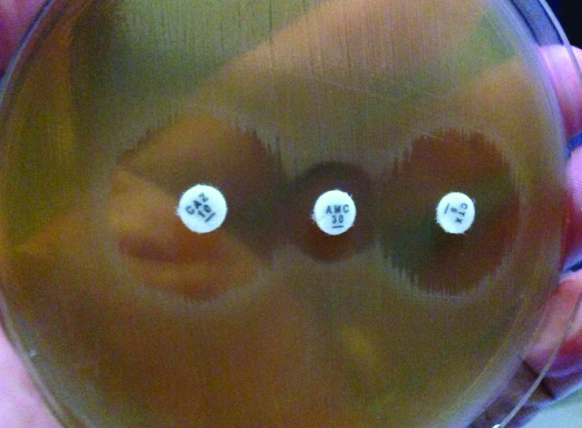 A picture of the double disk synergy test for Escherichia coli using ...