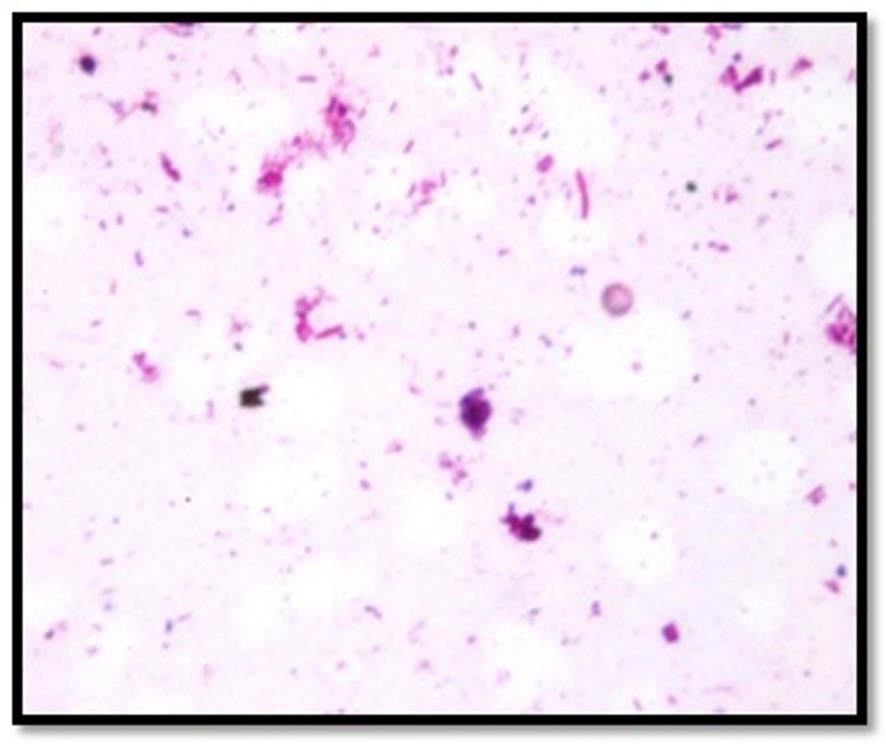 Jcdr Bacterial Cultures Dark Field Microscopy Gram Staining Viability