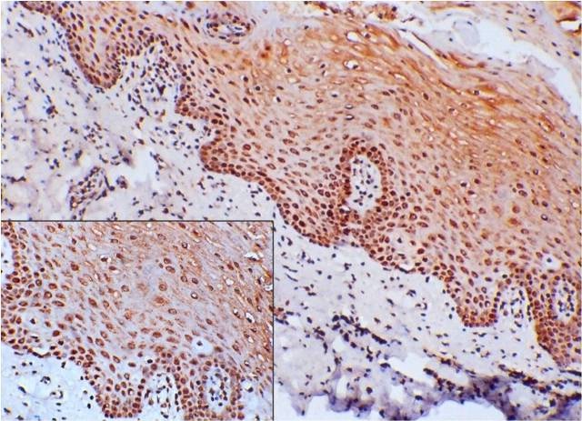 Perinuclear Staining Article Fulle Text
