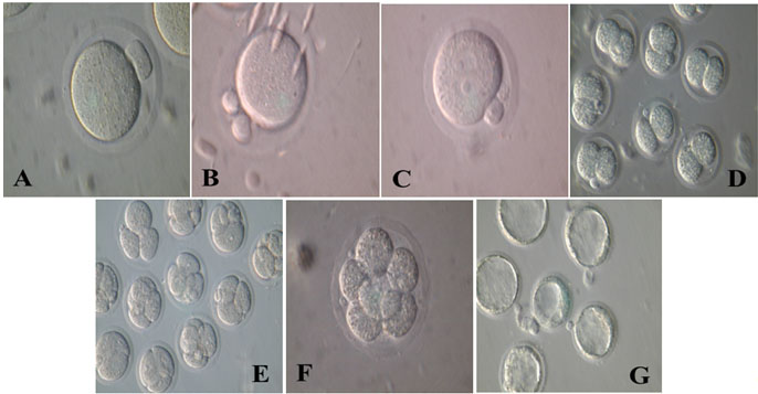 PDF) Insulin and IR-β in pig spermatozoa: A role of the hormone in