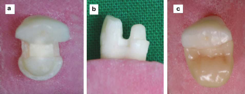 [Table/Fig-3]: